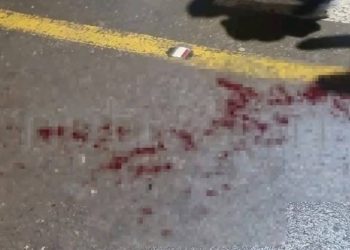 Dedo cercenado en Oruro seria provocado por un salto