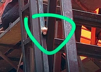 Joven que perdió su dedo en Oruro esta hospitalizado