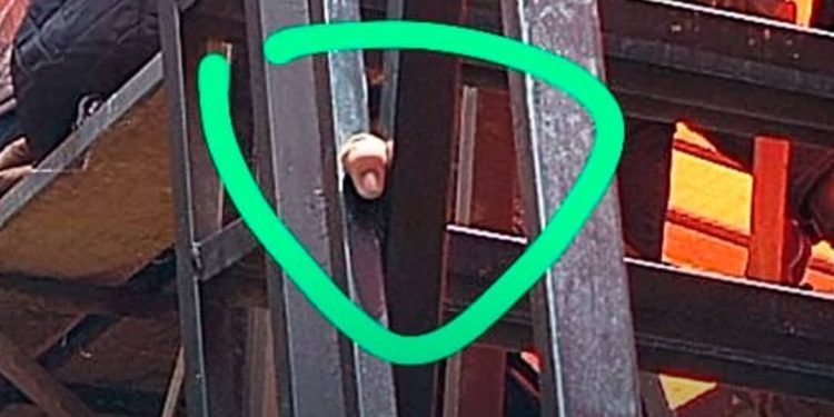 Joven que perdió su dedo en Oruro esta hospitalizado