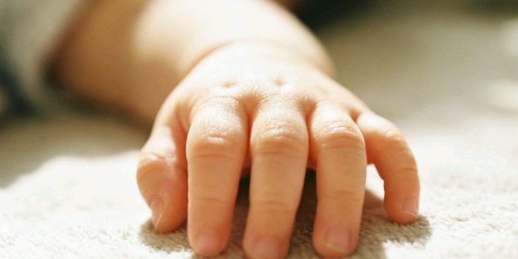 Bebé con chikungunya congénito permanece internado en Santa Cruz