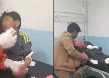 Violencia en protestas alcanza a un menor: niño pierde cinco dedos tras explosión de petardo